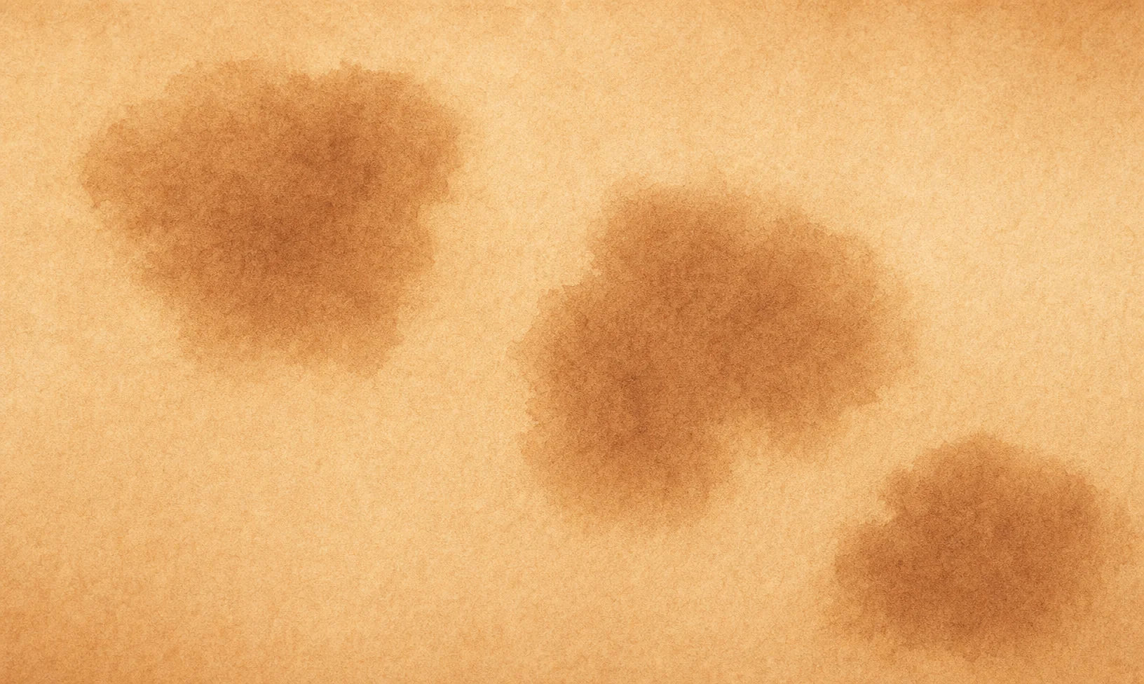 Skin swatch illustration showing epidermal melasma — three soft-edged warm brown patches on light tan skin