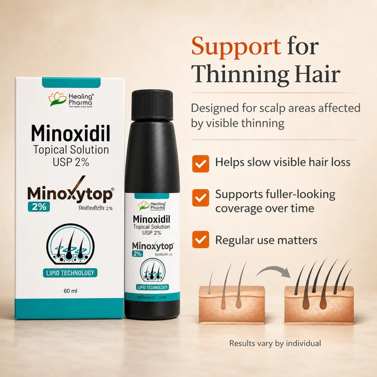 Minoxytop 2% support for thinning hair — slows visible hair loss, fuller-looking coverage, scalp follicle illustration