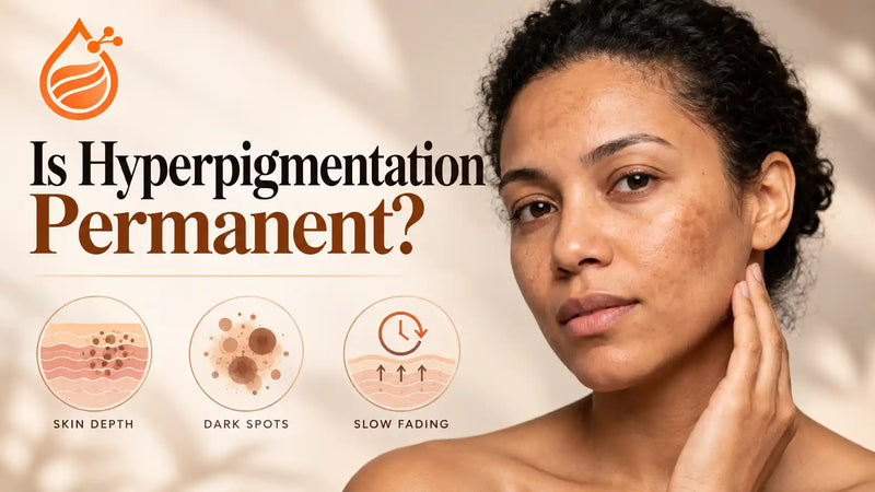 Why Hyperpigmentation Persists: Melanin Depth and Irritation